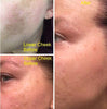 Dark Spot Corrector Remover for Face Melasma Treatment Fade Cream with Kojic Acid Vitamin C, Salicylic Acid, Azelaic Acid, Lactic Acid Peel (1oz)