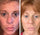 Dark Spot Corrector Remover for Face Melasma Treatment Fade Cream with Kojic Acid Vitamin C, Salicylic Acid, Azelaic Acid, Lactic Acid Peel (1oz)