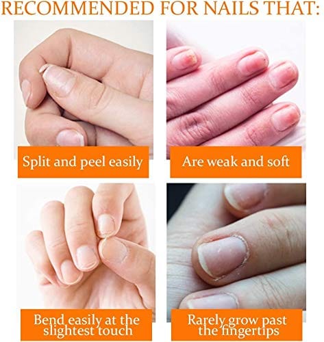 Nail Tek Nail Recovery Kit, Cuticle Oil, Strengthener, Ridge Filler - Restore Damaged Nails in 3 Steps